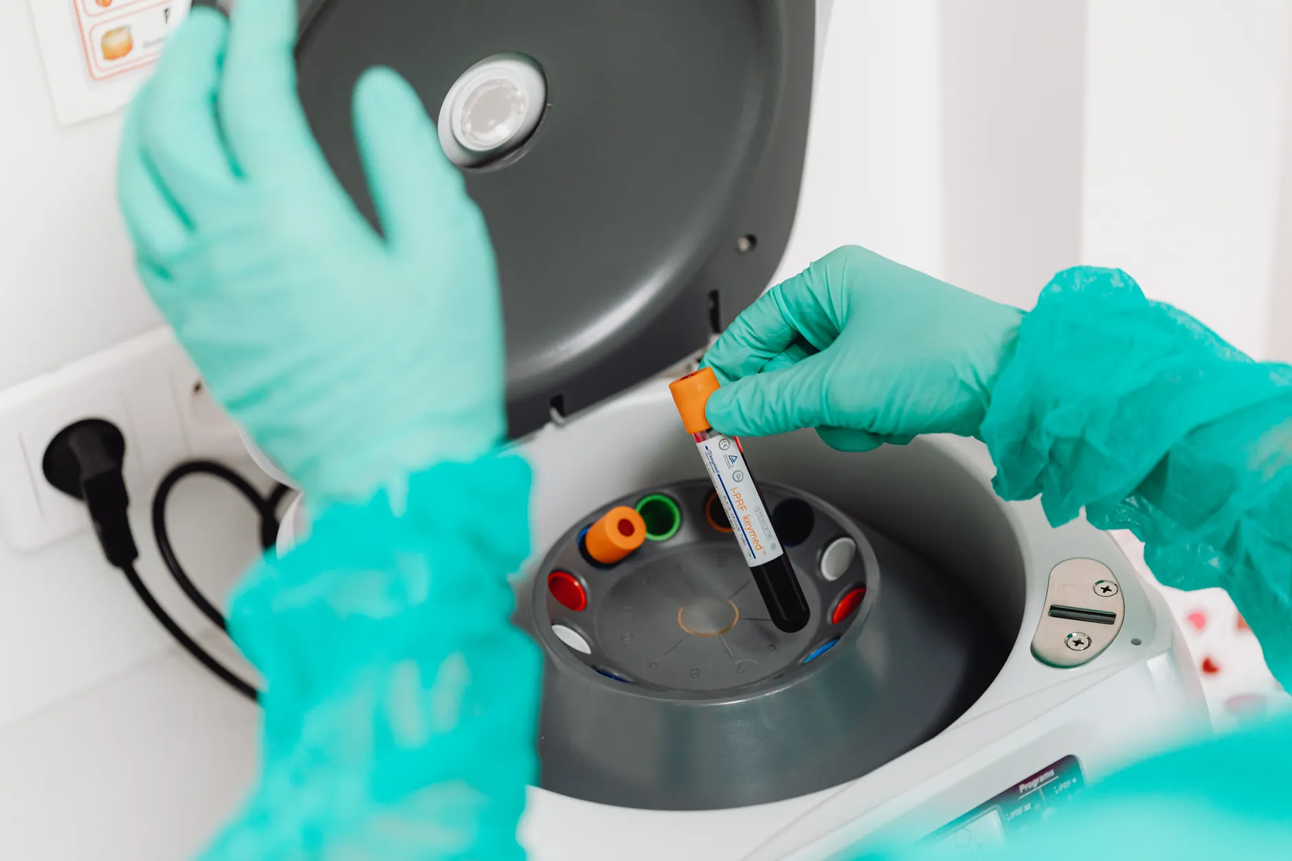 Alberta doctors and liver specialists coordinate to catch more hepatitis cases