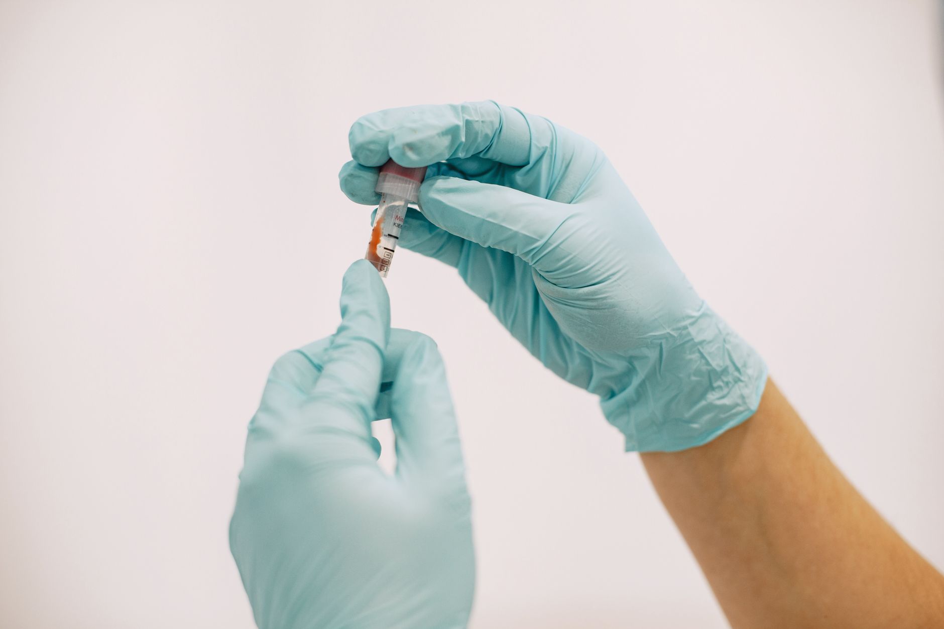 Vancouver's clinical trials test lactation drug to prevent postpartum breast cancer