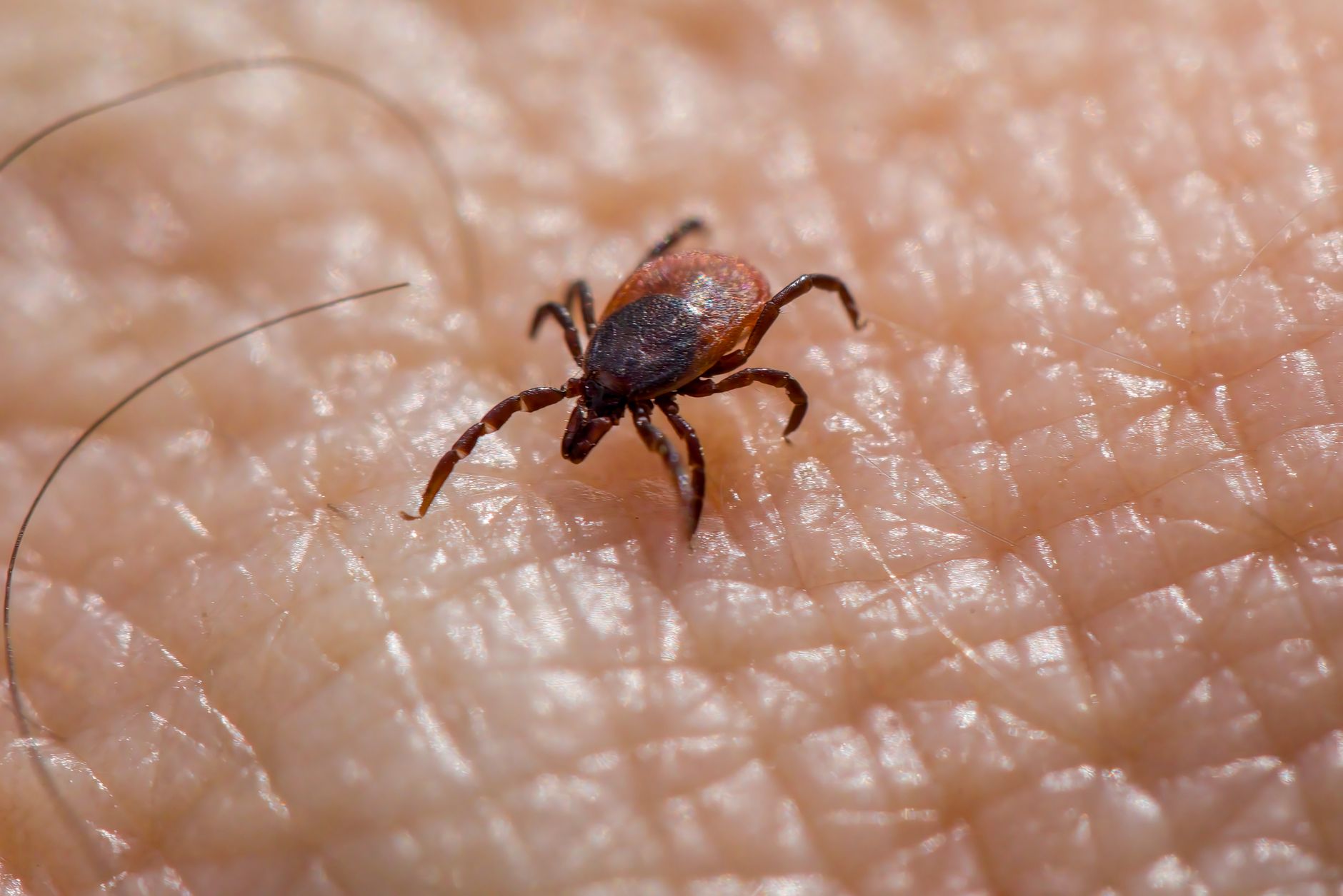 Unlicensed Edmonton practitioner posed blood-borne pathogen risk, province warns
